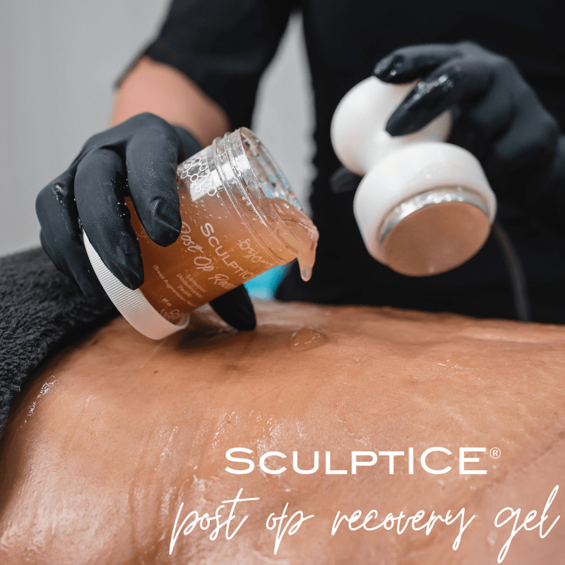 SculptICE Postr Op Gel4