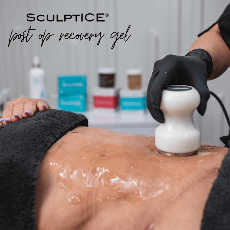 SculptICE Postr Op Gel5