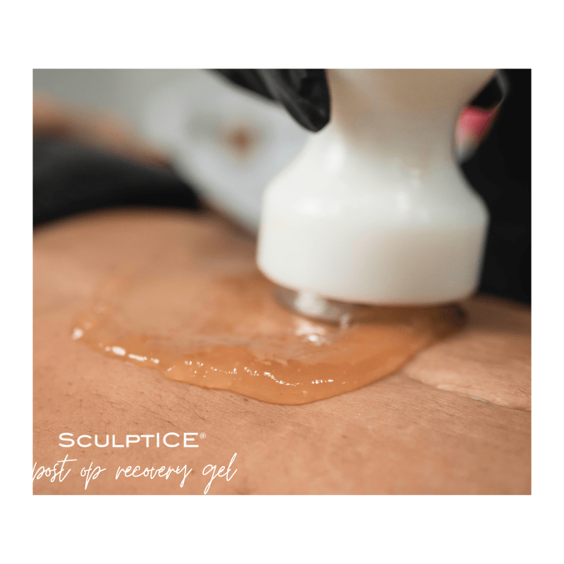SculptICE Postr Op Gel6